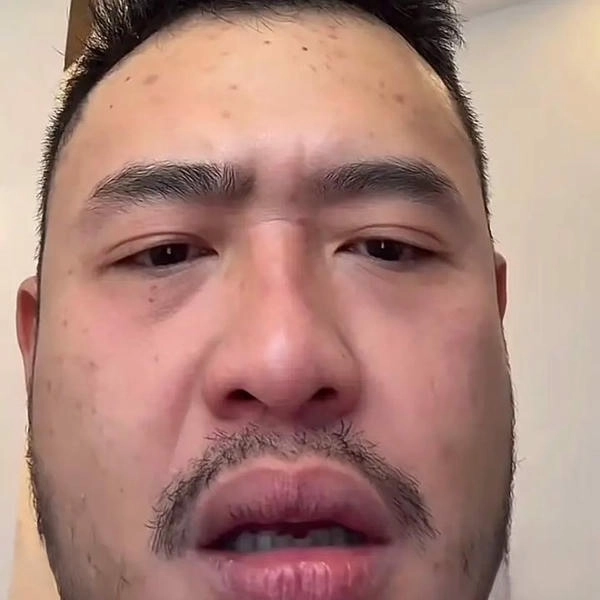 meme bất ngờ phản ứng 