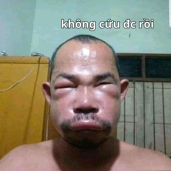 ảnh meme hết cứu dùng comment