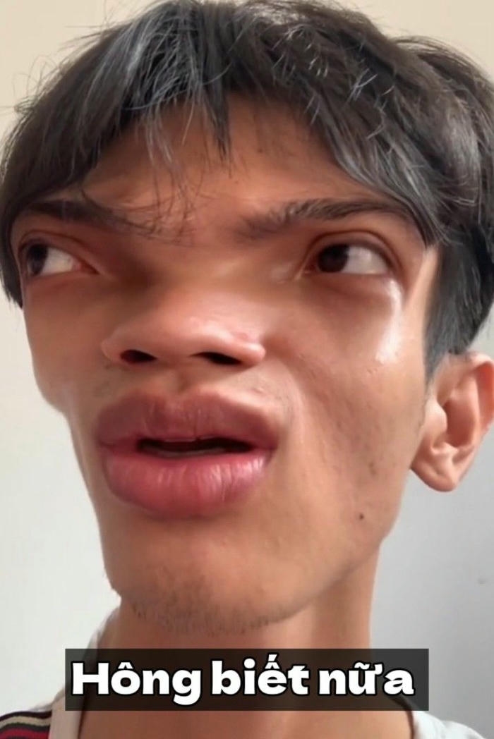 meme khùng mạc văn khoa