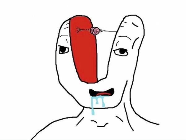 meme thiểu năng chế